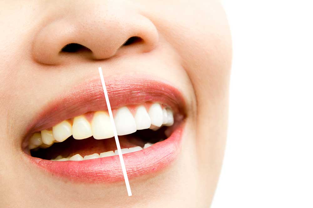 Image of Summersmiles Family Dental clinic - Dental Clinic Directory