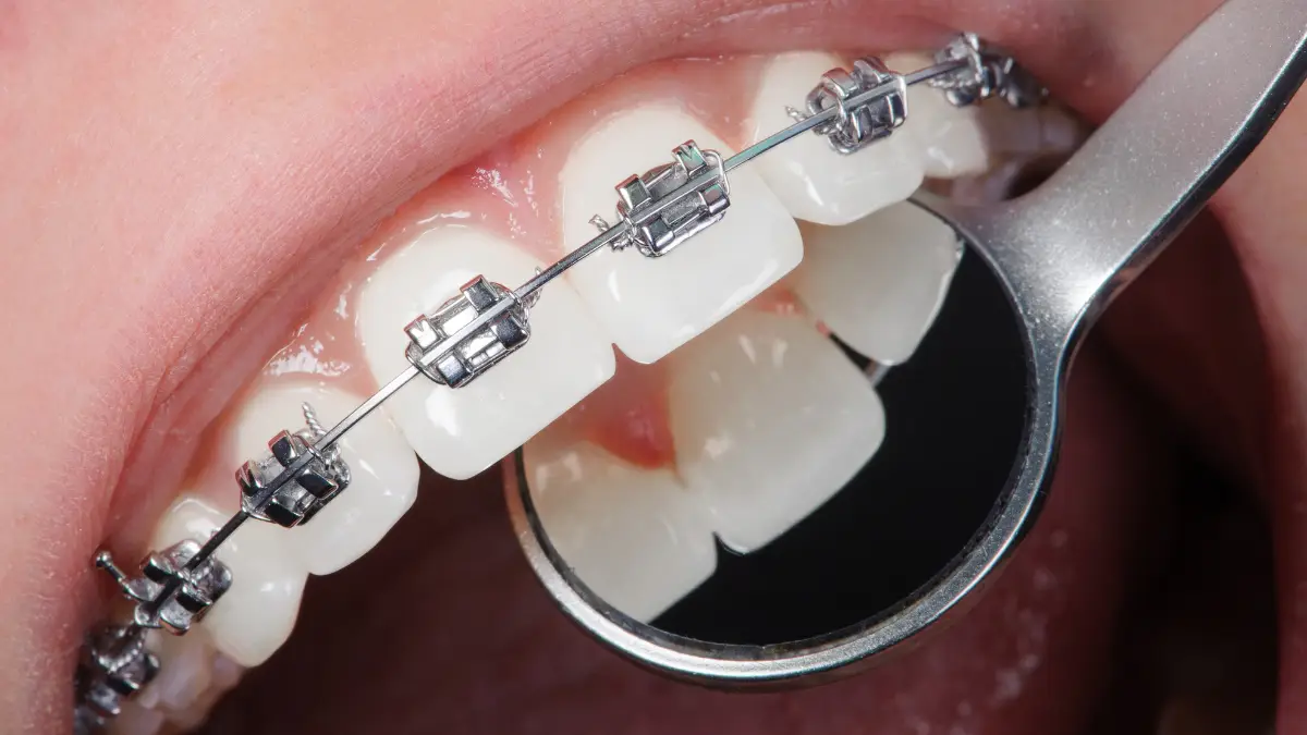 Image of Sunny Day Dental | Dental Office clinic - Dental Clinic Directory