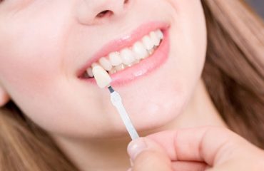 Image of Town Smiles Dental clinic - Dental Clinic Directory