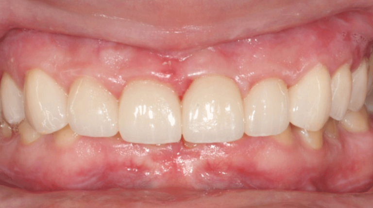 Village Walk Family Dental