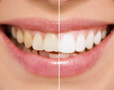 Image of WestEnd Smiles Drs Frank Lee and Jae Park clinic - Dental Clinic Directory