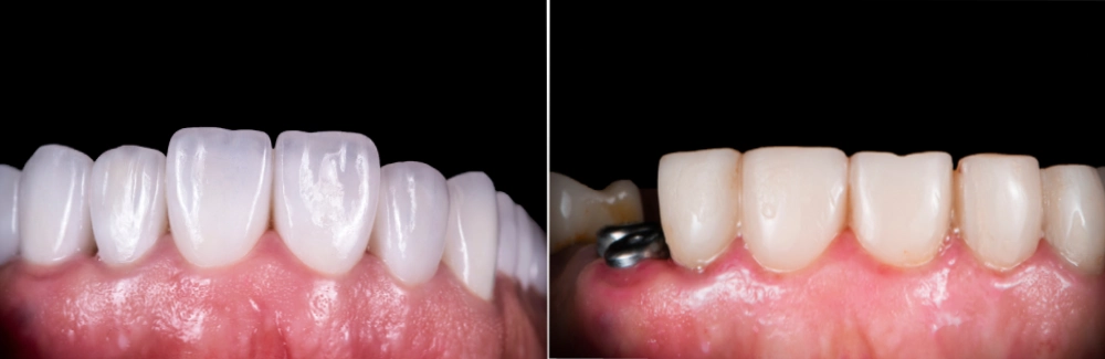 Image of West Metro Dental clinic - Dental Clinic Directory