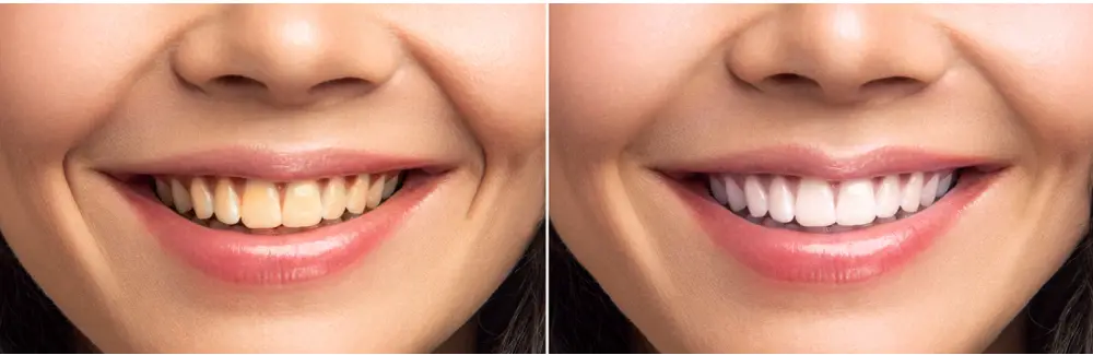 Image of West Metro Dental clinic - Dental Clinic Directory