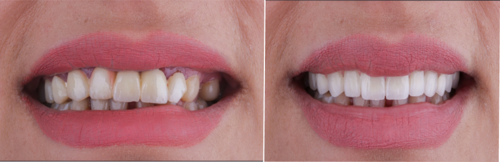Image of West Metro Dental clinic - Dental Clinic Directory