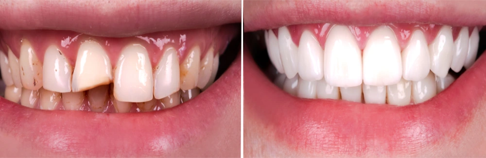 Image of West Metro Dental clinic - Dental Clinic Directory