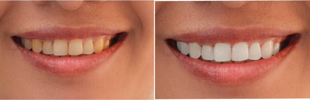 Image of West Metro Dental clinic - Dental Clinic Directory