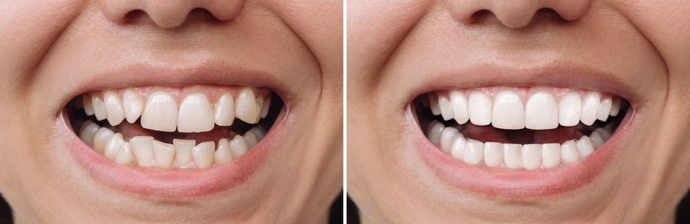 Image of West Metro Dental clinic - Dental Clinic Directory
