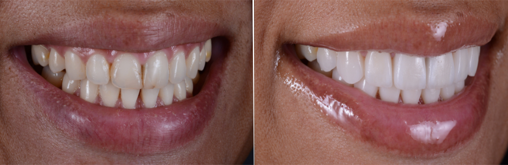 Image of West Metro Dental clinic - Dental Clinic Directory