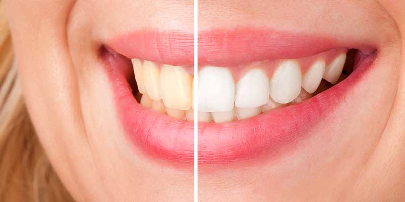 Image of White Canvas Dentistry clinic - Dental Clinic Directory