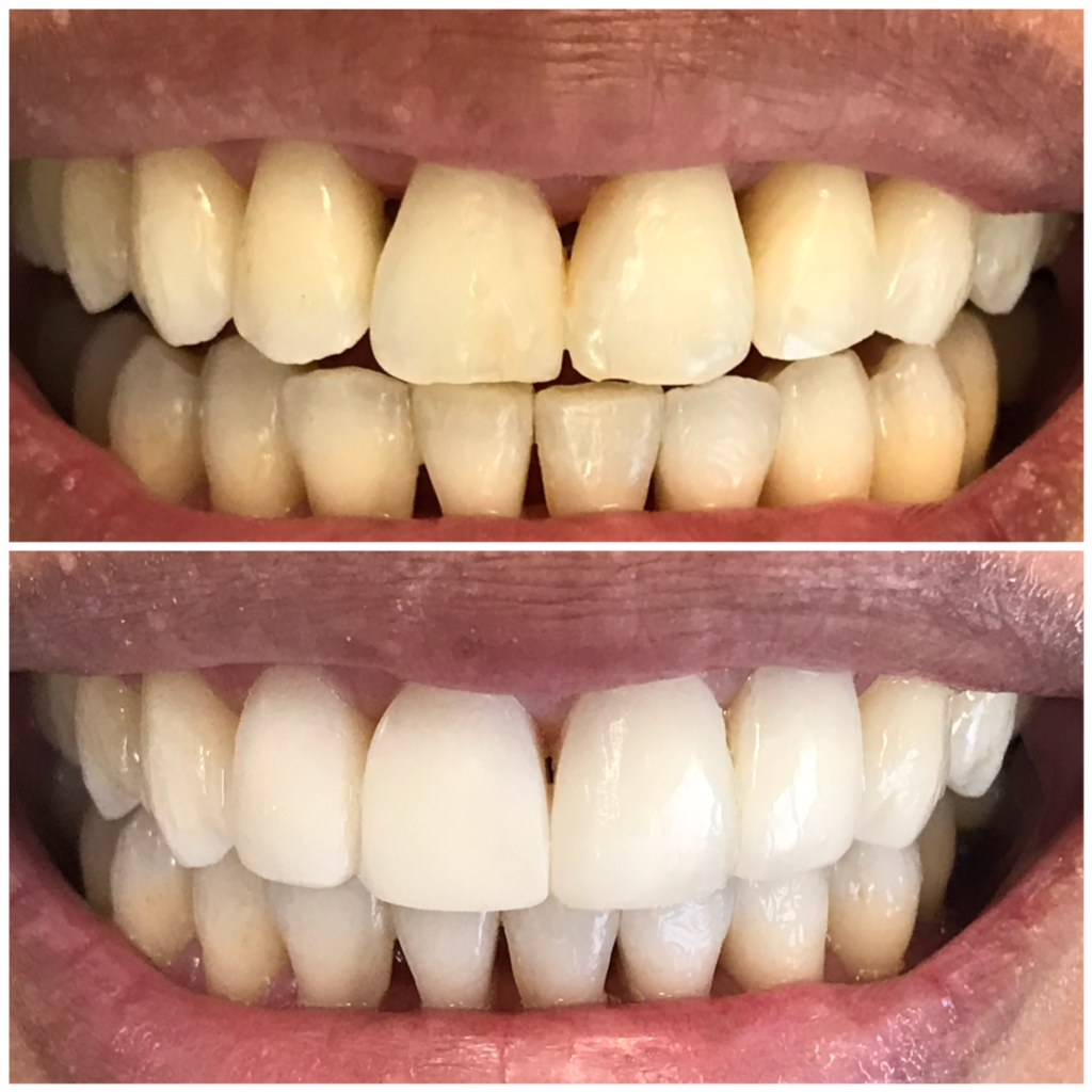 Ajax Dental Smiles