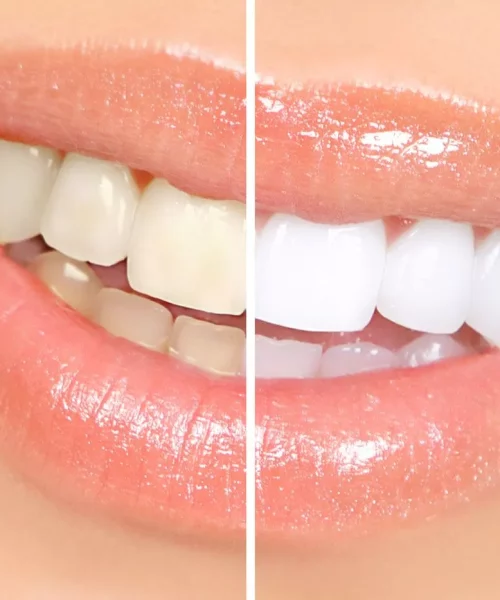 Image of Artisan Dental Waterdown clinic - Dental Clinic Directory