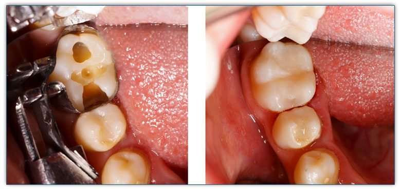 Britannia Dental Care-Dr.Sidhu