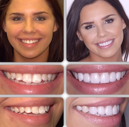 Image of Britannia Dental Care-Dr.Sidhu clinic - Dental Clinic Directory