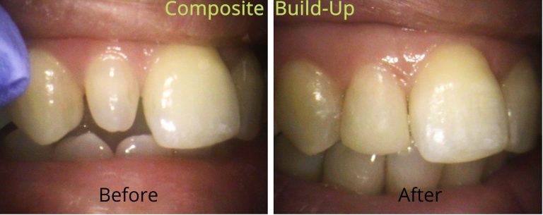 Image of Britannia Dental Care-Dr.Sidhu clinic - Dental Clinic Directory