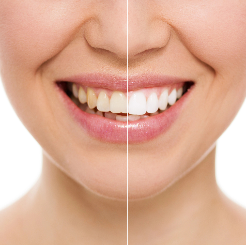 Image of Calma Dental Oakville clinic - Dental Clinic Directory