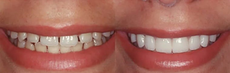 Cliffcrest Family Dental