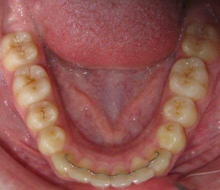 Image of Davis Orthodontics-Danforth clinic - Dental Clinic Directory