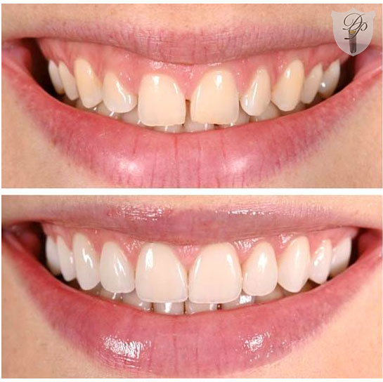 Davisville Periodontics & Dental Implants