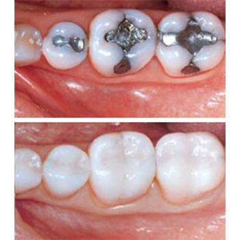 Dental Health Centre in the Kingsway- Dr Kutzko & Dr Kola