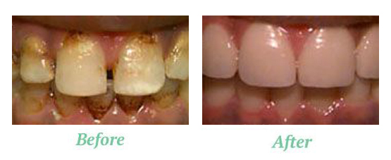 Image of Estrabillo Dental Group clinic - Dental Clinic Directory