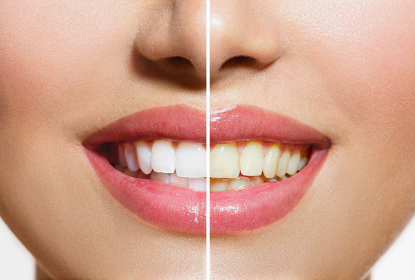 Erin Mills Dental Centre