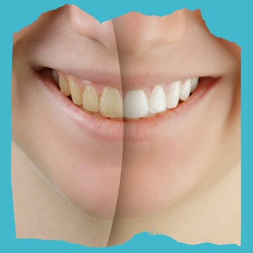Image of Frizzell Dental clinic - Dental Clinic Directory