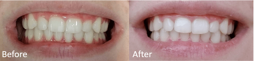 Galt Dental Care