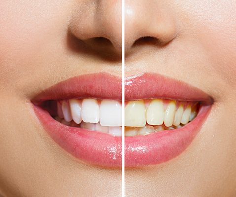 Image of Horizon Dental clinic - Dental Clinic Directory