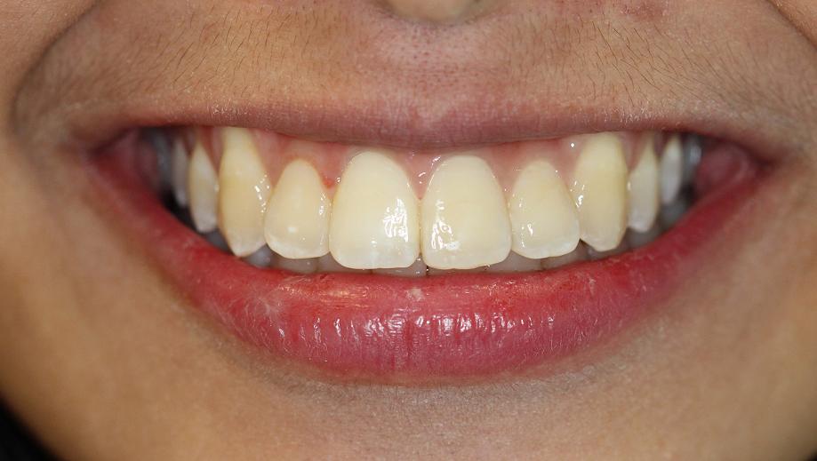 North York Dental Clinic
