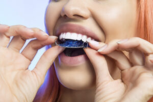 Root Cause Dental Group - Sepehr JafarPour DDS