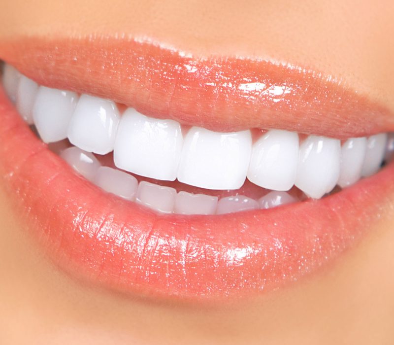 Image of Peel Dental Care clinic - Dental Clinic Directory