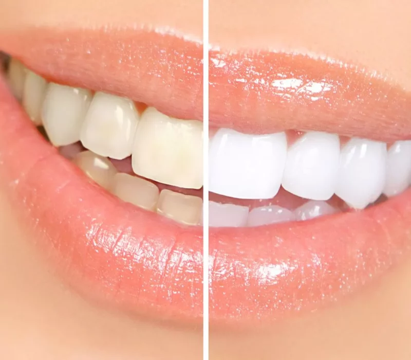Image of Peel Dental Care clinic - Dental Clinic Directory