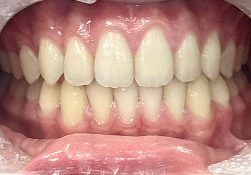 Image of Steeles Weston Family Dental North York clinic - Dental Clinic Directory