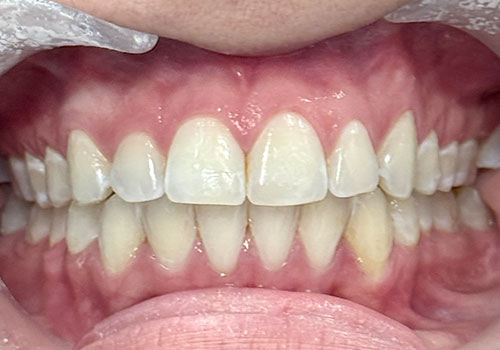 Image of Steeles Weston Family Dental North York clinic - Dental Clinic Directory