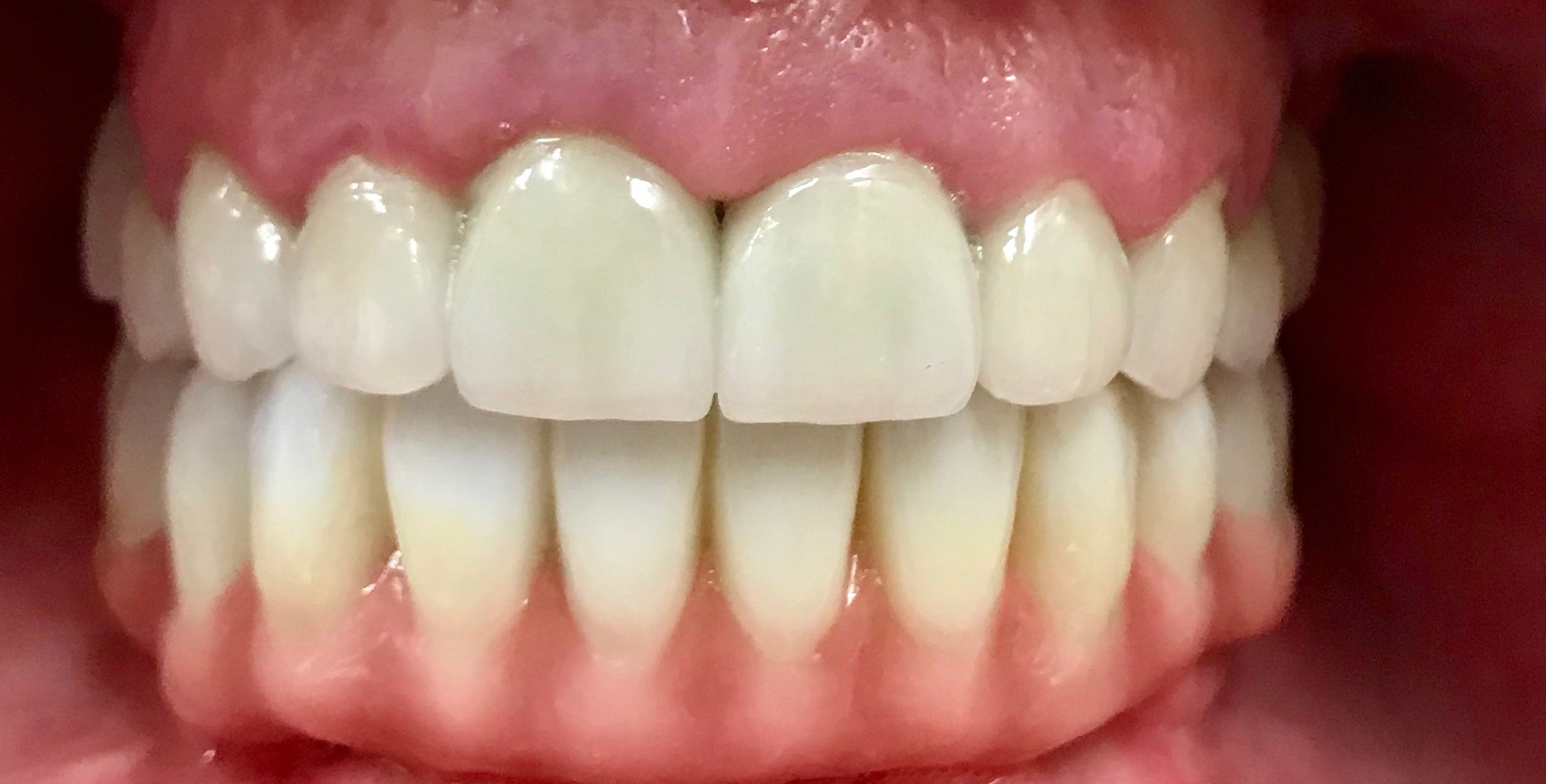 West Bowmanville Family Dental