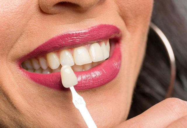 Weston Dental Office - Dr. Fariba Shokoohi Razi & Associates