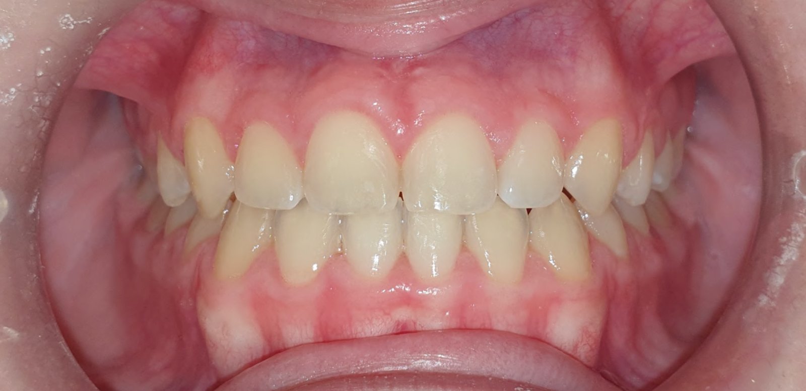 Image of York Orthodontics - North York clinic - Dental Clinic Directory