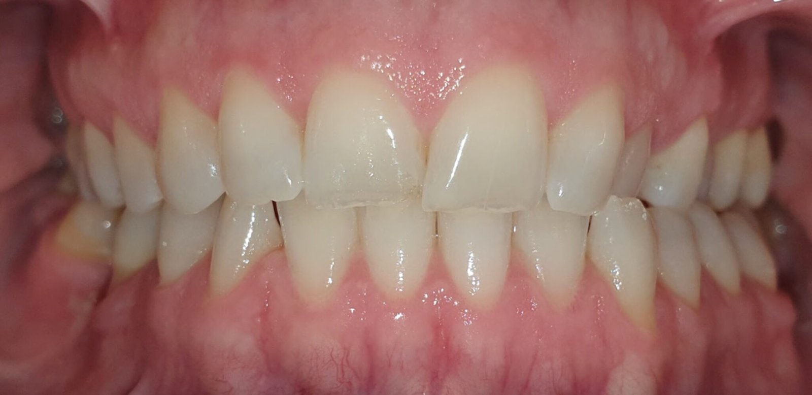 York Orthodontics - Thornhill