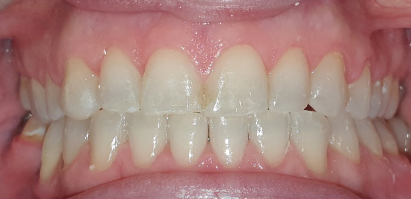 Image of York Orthodontics - North York clinic - Dental Clinic Directory