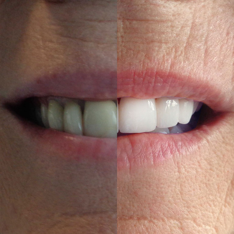 Your Windsor Dental Care