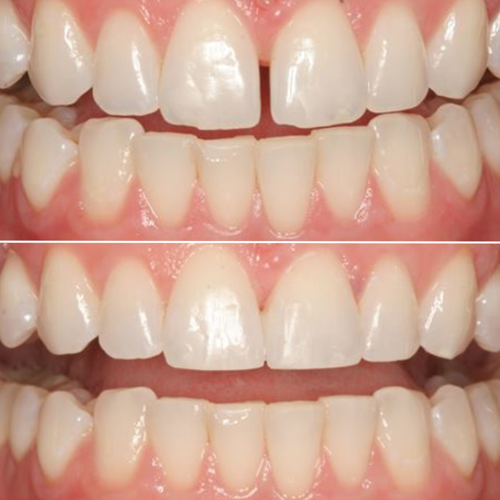 Image of Zircon Dental - Dr. Ali Nasser clinic - Dental Clinic Directory