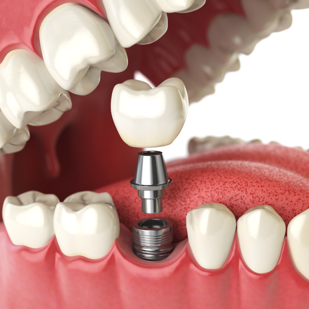 Image of Zircon Dental - Dr. Ali Nasser clinic - Dental Clinic Directory