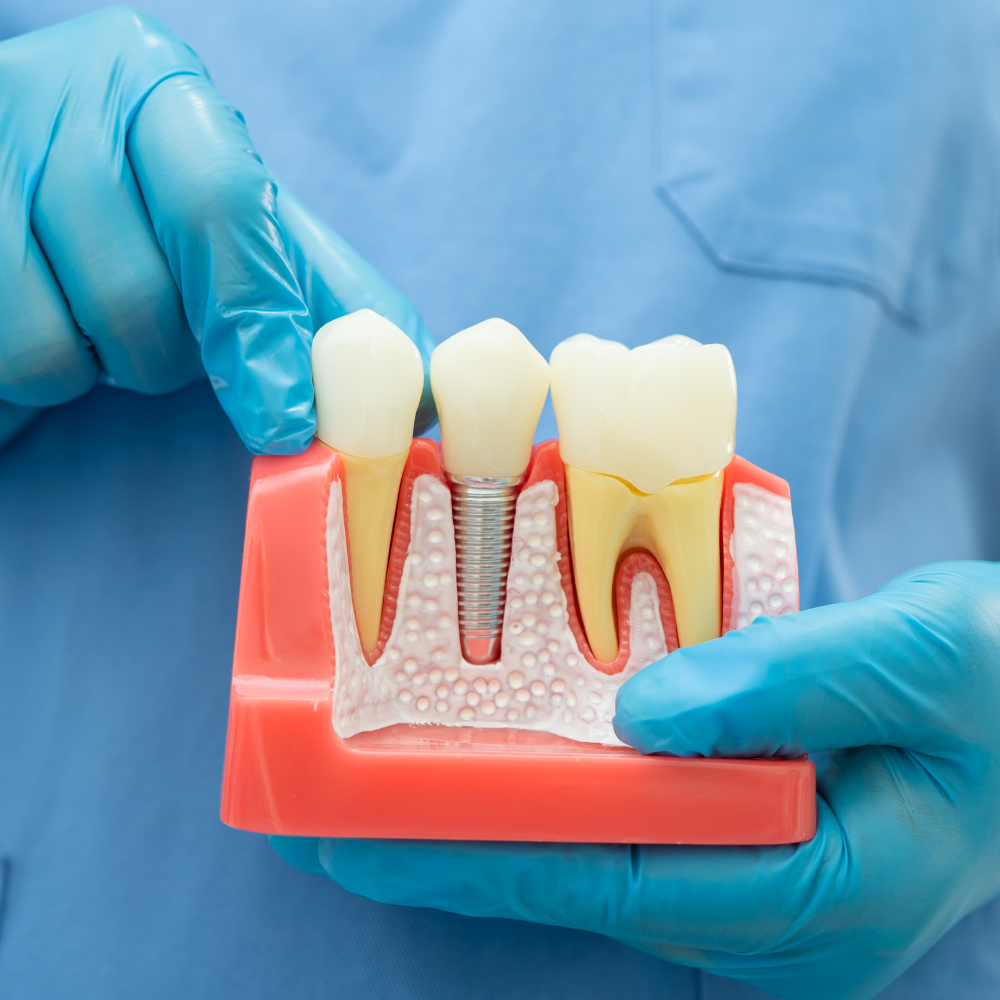 Image of Zircon Dental - Dr. Ali Nasser clinic - Dental Clinic Directory