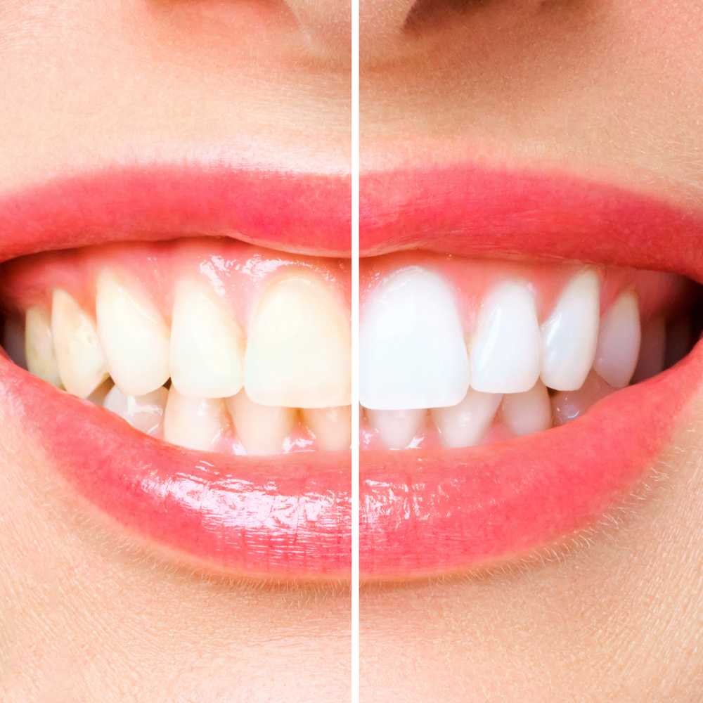Zircon Dental - Dr. Ali Nasser